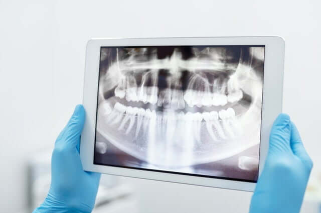 Stomatolog RAdom Orzeł Dental Care oferuje szereg profesjonalnych usług