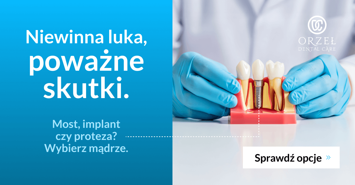 Brak zęba - jak go uzupełnić