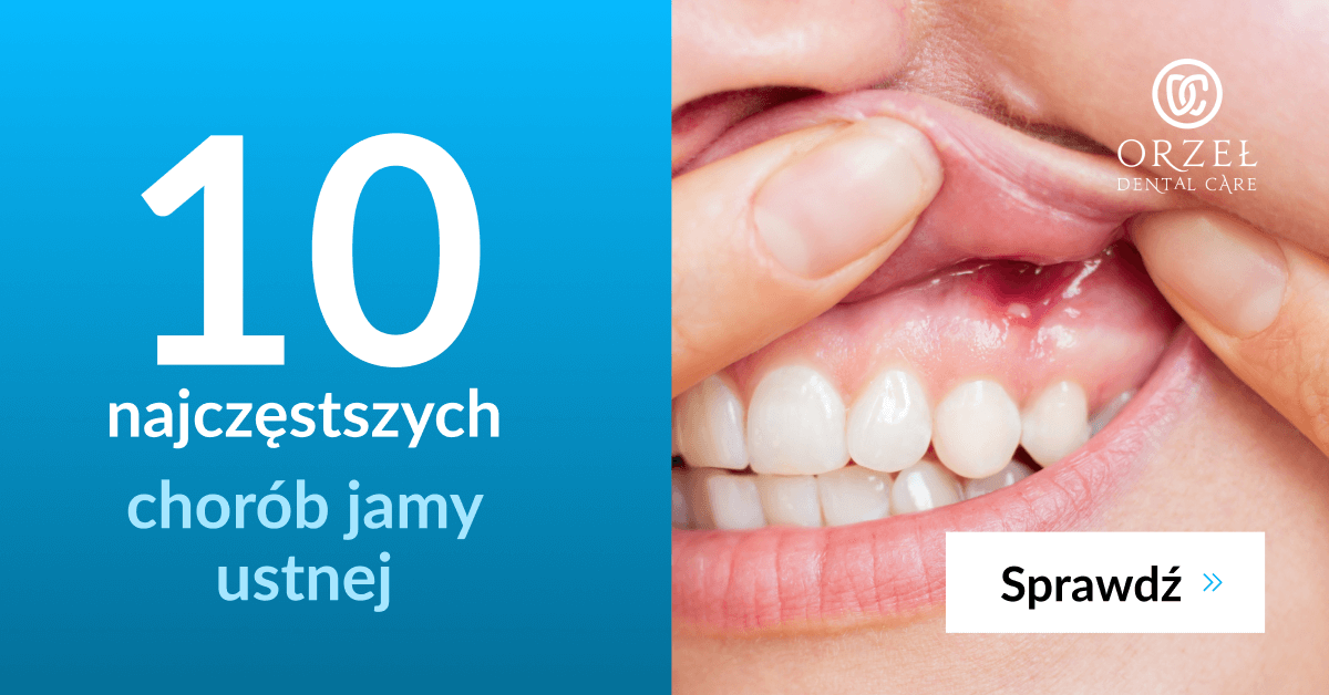 choroby jamy ustnej - Orzeł Dental Care