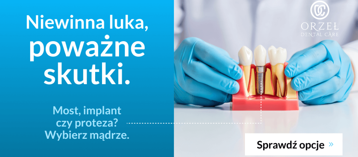 Brak zęba - jak go uzupełnić