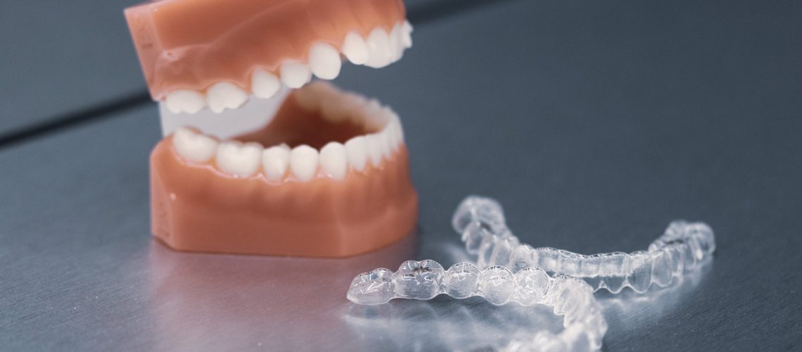 Aparat zębowy u Ortodonty w Radomiu