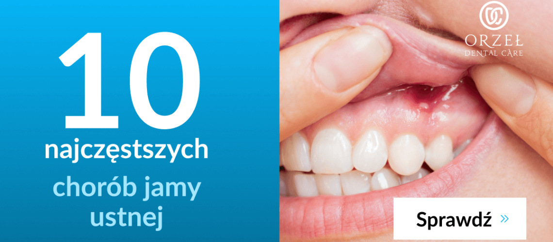 choroby jamy ustnej - Orzeł Dental Care