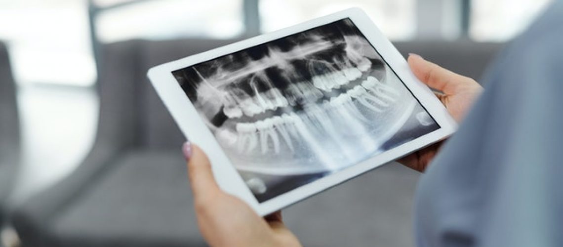 Orzeł Dental Care Radom - dentysta i ortodonta