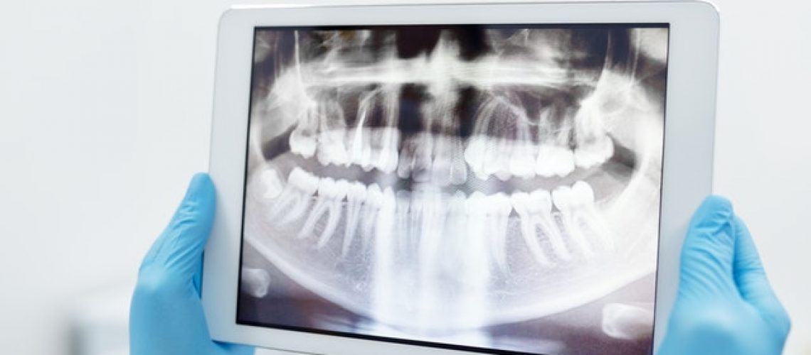 Stomatolog RAdom Orzeł Dental Care oferuje szereg profesjonalnych usług
