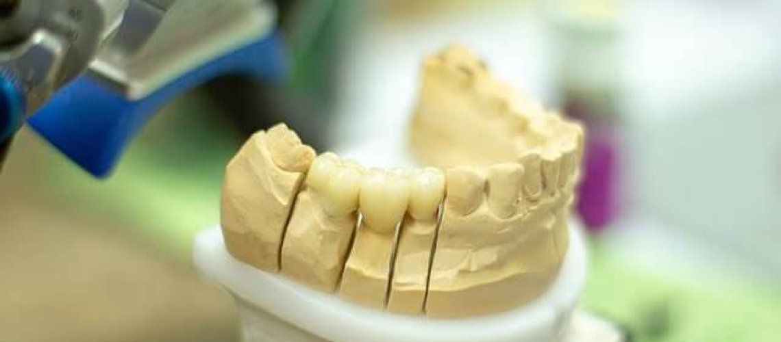 Aparat ortodontyczny w dobrej cenie - Orzeł Ortodonta Radom